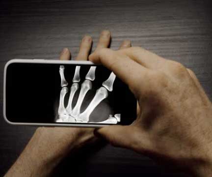 Aplicativo que imita a funcionalidade de raio-X em seu smartphone